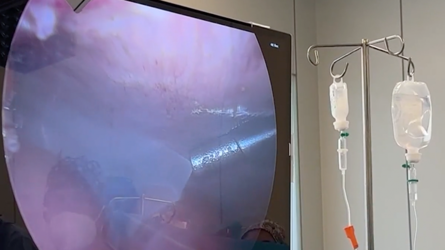 Zabieg PIPAC, Szpital Wojewódzki w Poznaniu, nowotwór, Dawid Murawa (fot. Szpital Wojewódzki w Poznaniu)