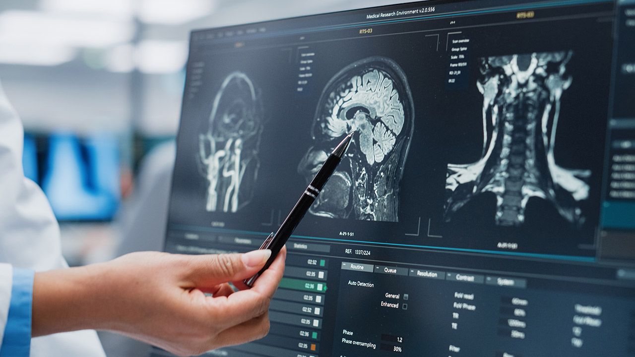Bezinwazyjne metody diagnostyki guzów mózgu  (fot. Shutterstock/Gorodenkoff)
