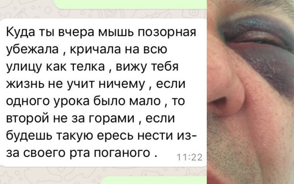 Раман прыслаў «Белсату», як ён сцвярджае, скрыншот пагрозаў яму ад Міхайла (злева) і фота яго пасля пабіцця Міхайлам і ягонымі супрацоўнікамі (справа).
